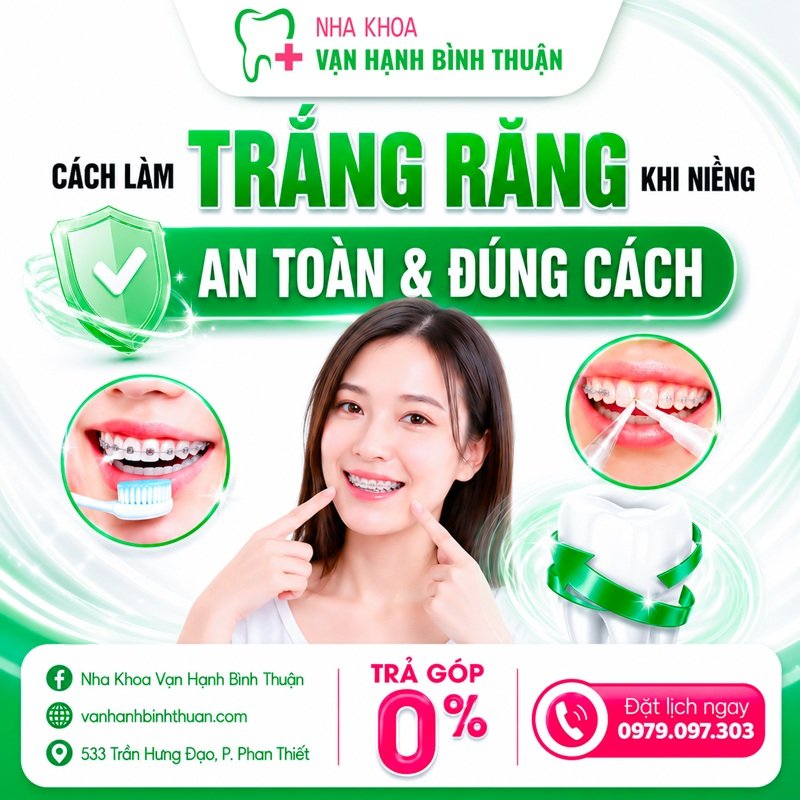 Cách làm trắng răng khi niềng an toàn và đúng cách